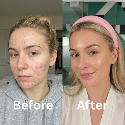 Glowvella Collagen Night Mask